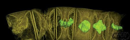 ��ѧ���Ѿ�������˹�����Ĥֲ������Իָ��������˵�������