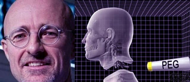 ��������ҽ����һֻ����ڶ���ͷ��������ʵ������ͷ����ֲ������